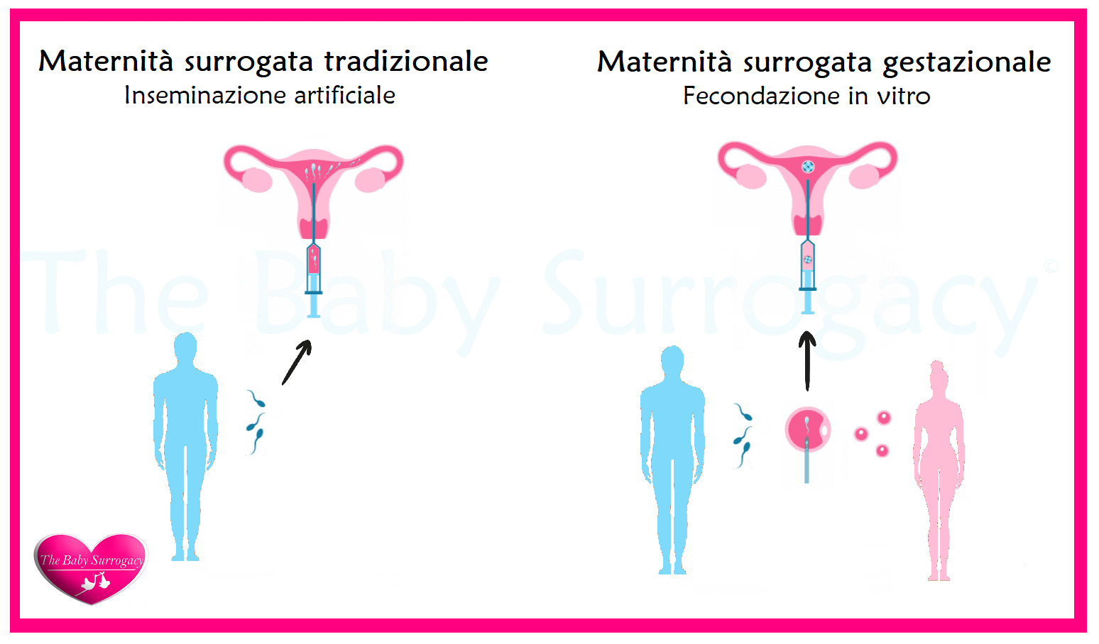 Tipi di maternità surrogata e relativo procedimento IVF