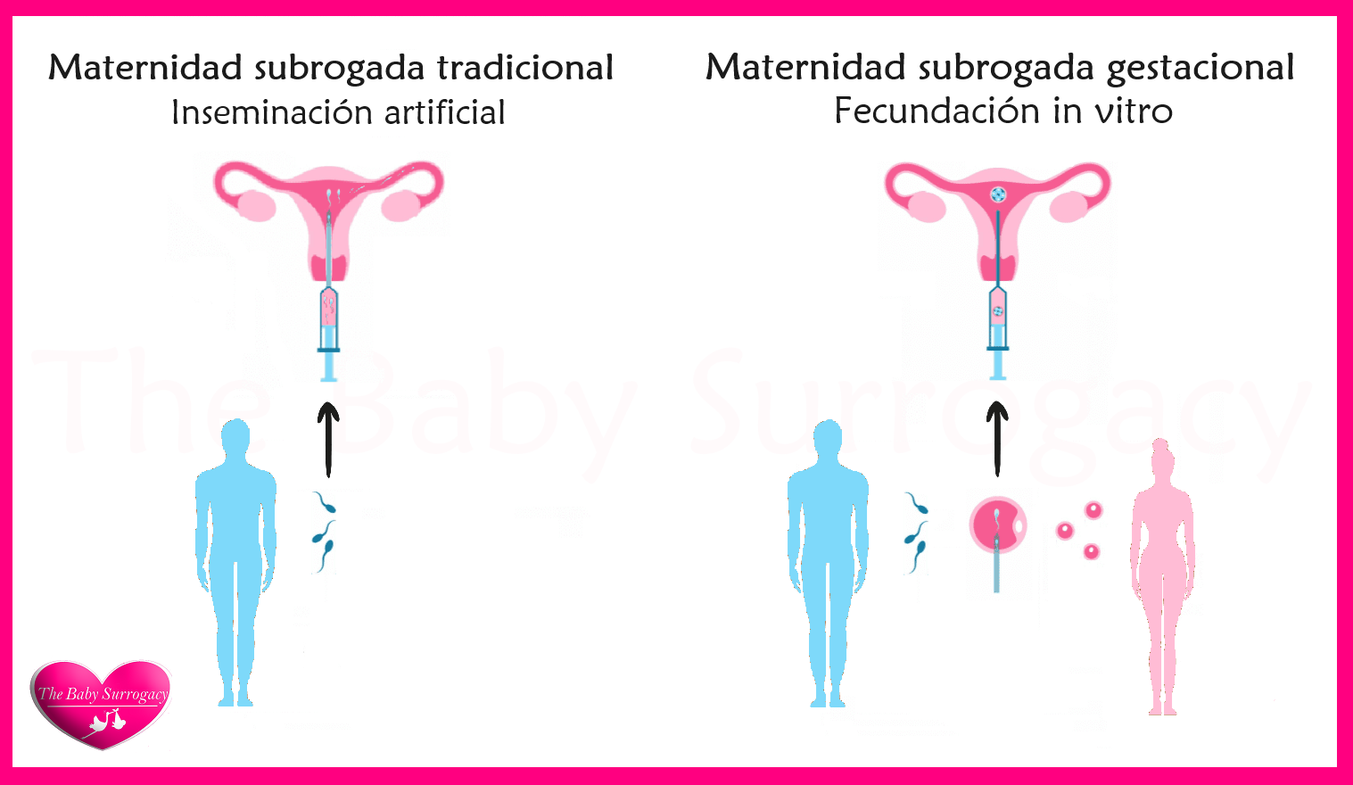 proceso de  gestacion subrogada 